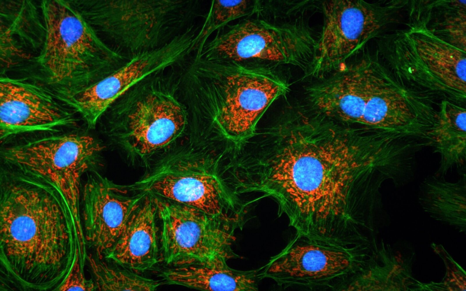 AcquCAM 23GR2 fluorescence Image