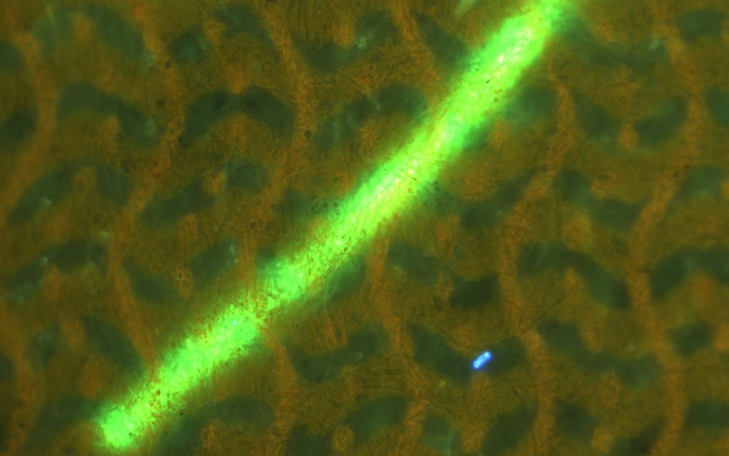 Simultaneous observation of fluorescence microscopy and bright field microscopy
(동시관찰) 5만원 지폐의 형광 관찰 (Image taken with AcquCAM 23GR2)