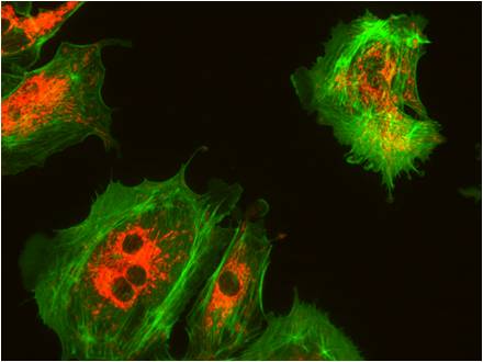 Rapid and smooth frame of Max. 20 fps These images were shot by AcquCAM Gold3 Package.