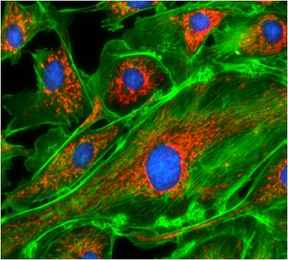 These images were shot by AcquCAM Silver Package.