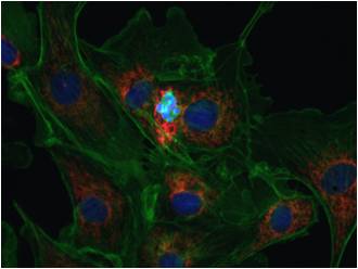 Shooting images of fluorescence sample