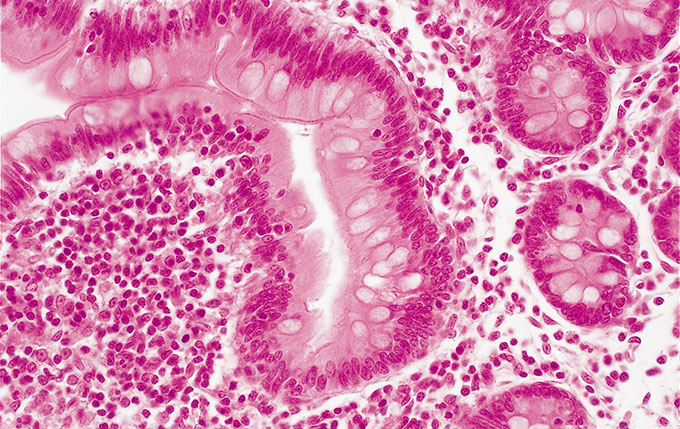 CX31_01_outstanding_flat_images_with_plcn_objectives