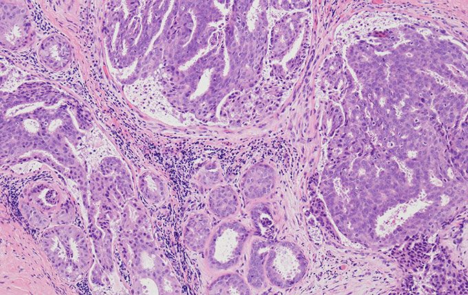 명시야(Brightfield)