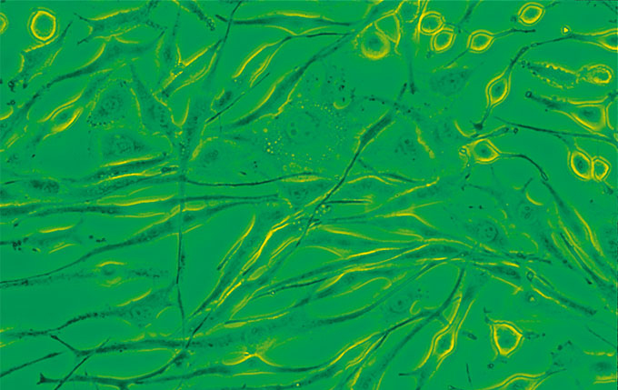 위상차(Phase Contrast)