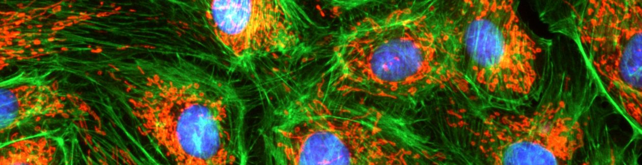 (주)제이엔옵틱