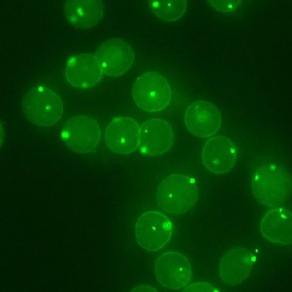 Inadequat Contrast Image for FISH