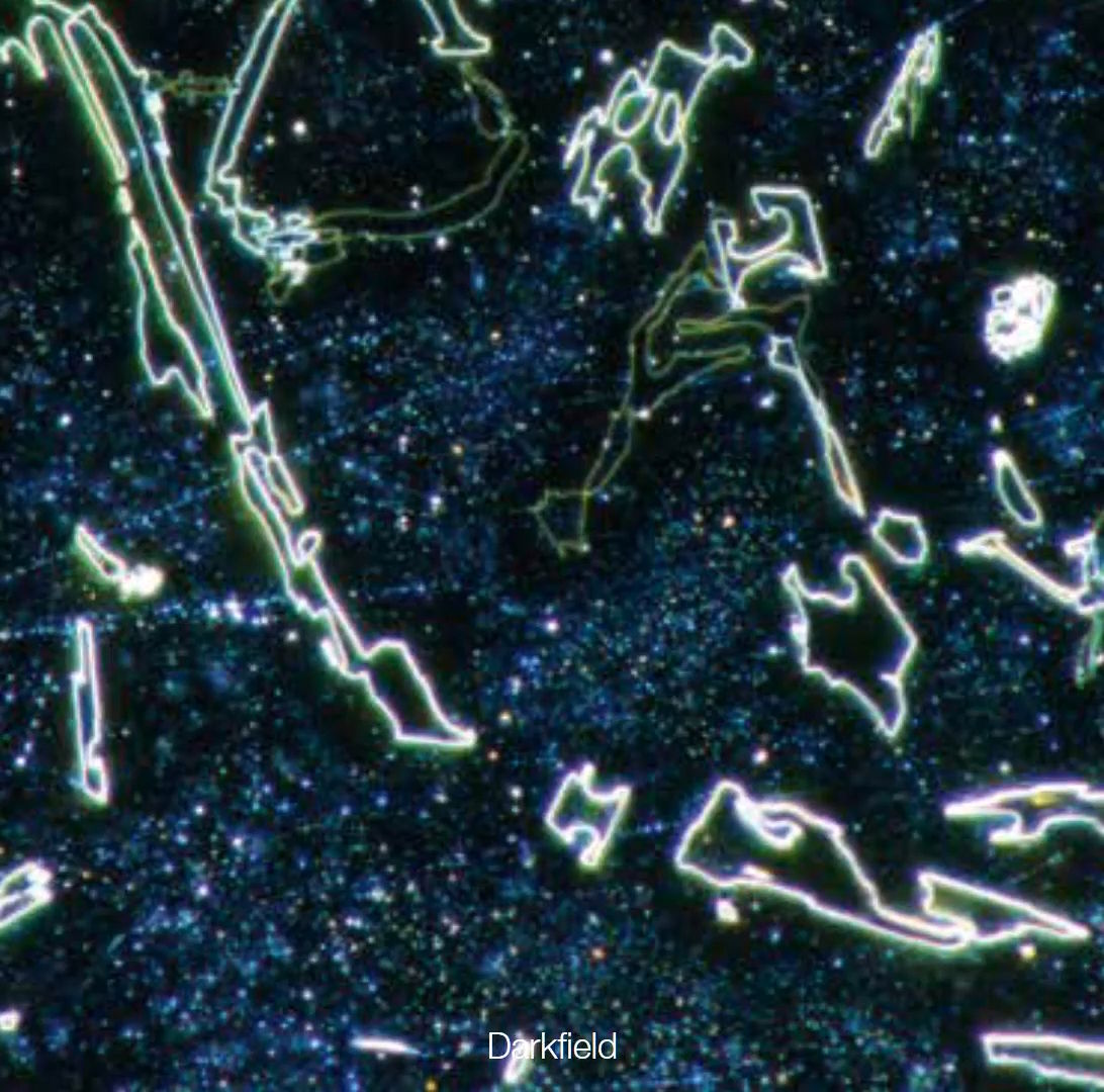 Dark Filed Image with BX53M